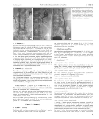 Radiodiagnostic Traitement endovasculaire des varicocèles 34-450-D-10 
*A *B *C 
¦ À droite (fig 7) 
La veine testiculaire se termine dans 95 % des cas dans la veine cave 
inférieure en regard du pédicule de L2 (fig 8, 9), mais sa terminaison 
est variable allant du pédicule de L1 jusqu’à L4. En outre, la veine 
testiculaire peut se terminer directement dans la veine rénale très 
près de sa terminaison, à son bord inférieur, cela dans 10 % des cas. 
Dans 5 % des cas, il existe donc une terminaison double à la fois 
dans la veine cave inférieure et dans la veine rénale (fig 10, 11, 12). 
Il faut donc pour gagner du temps, injecter immédiatement en 
scopie du contraste dans la veine rénale droite de façon à éliminer 
la possibilité d’une terminaison de la veine testiculaire à ce niveau, 
avant de la rechercher sur la face antérodroite de la veine cave 
inférieure. Rappelons que la veine rénale droite peut être double : la 
veine testiculaire s’abouche le plus souvent dans l’inférieure mais sa 
terminaison dans la supérieure n’est pas exclue. 
¦ Valvules (fig 8, 9, 13, 14, 15) 
Normalement présents, les appareils valvulaires permettent à la 
colonne sanguine de ne circuler que dans le sens antégrade de bas 
en haut. Leur insuffisance ou leur absence sont à l’origine d’un 
reflux générateur de varicocèle. 
Les valvules sont présentes plus fréquemment à droite (60 % des 
cas) qu’à gauche au niveau ostial. En général, elles se situent très 
près de la terminaison. Il peut exister des valvules supplémentaires 
au niveau lombaire, voire pelvien bas. 
VARIATIONS DE LA VEINE CAVE INFÉRIEURE (fig 3) 
Des variations anatomiques de la veine cave inférieure modifient les 
repères de terminaison de la veine testiculaire. 
La veine cave inférieure gauche donne une image en miroir avec 
une veine droite s’abouchant dans la veine rénale, et une veine 
gauche se terminant dans la veine cave inférieure gauche, ou à son 
confluent avec la veine rénale. 
En cas de double veine cave inférieure, la veine testiculaire gauche 
peut se jeter dans la partie terminale de la veine cave inférieure 
gauche ou à son confluent avec la veine rénale. 
AU NIVEAU LOMBAIRE 
¦ Calibre - nombre 
La largeur de la veine spermatique est d’environ 5 à 8mm à gauche 
et peut dépasser 12 mm en cas de varicocèle importante. 
4 (A, B, C) Variations anatomiques de la 
veine rénale gauche. Double arc veineux rénal : 
la veine testiculaire s’abouche en Y dans la 
veine rénale inférieure. Le cathétérisme montre 
la présence de collatérales (flèches) importantes 
à différents niveaux. 1 : veine cave inférieure ; 
2 : veine rénale inférieure ; 3 : terminaison en Y 
de la veine testiculaire ; 4 : anastomose. 
La veine testiculaire peut être unique (fig 5, 10, 16, 17). Une 
variation importante est le caractère double (fig 18), voire 
plexiforme, de la veine testiculaire. 
¦ Collatérales parallèles 
Des collatérales parallèles au tronc spermatique (fig 4C, 5C, 6A), très 
fines, étagées sont très fréquentes. Ces collatérales peuvent se dilater 
et être la cause d’une varicocèle, avec un tronc veineux testiculaire 
valvulé (plus ou moins haut). Les récidives postchirurgicales [47] sont 
dues à ces collatérales. 
¦ Anastomoses [17, 19] 
Avec le système veineux lombaire 
Elles siègent au niveau de l’arc réno-azygo-lombaire ou plus bas 
situées avec le système veineux périvertébral. Ces anastomoses sont 
plus fréquentes à gauche (40 %) qu’à droite (8-10 %) [9, 12] (fig 19). 
Avec le système veineux urétérique 
Les veines urétériques rejoignent l’hypogastrique. Les anastomoses 
sont assez fréquentes (19 % à gauche, 8 % à droite). 
Toutes ces anastomoses sont de petite taille. 
Avec le système veineux rénal 
Ces anastomoses peuvent se faire par des petites collatérales avec 
les veines du hile du rein, avec les branches péricapsulaires et 
s’associent aux anastomoses pariétales. Ces anastomoses en cas de 
tronc valvulé se dilatent et prennent un aspect sinueux, habituel 
dans ces circulations de suppléance. Leur cathétérisme est le plus 
souvent impossible (fig 4B, 12, 20, 21, 25, 27, 28). 
Anastomoses pariétales 
Rétropéritonéales, de trajet externe, elles se jettent dans les dernières 
intercostales. Ces anastomoses sont habituellement fines, peu 
marquées mais elles peuvent être la cause principale d’une 
varicocèle lorsque le tronc veineux testiculaire est valvulé (fig 21). 
Avec le système veineux splanchnique [6, 14, 78] 
À gauche, il s’agit de la veine mésentérique inférieure, parfois de la 
veine splénique et à droite de la veine grande mésentérique. Ces 
anastomoses sont le plus souvent alimentées par de très fines 
collatérales transpéritonéales et ne sont visibles que si l’injection est 
faite à un débit important dans la partie terminale de la veine. 
En outre, il existe des anastomoses par un tronc pariétocolique 
naissant au niveau de la crête iliaque ; ce tronc est valvulé 
5 
 