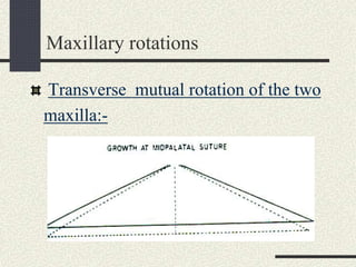 Maxillary Plane Rotation Trajectories and rotations 6 | PPT