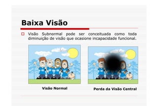 Baixa Visão
 Visão Subnormal pode ser conceituada como toda
 diminuição de visão que ocasione incapacidade funcional.




        Visão Normal              Perda da Visão Central
 