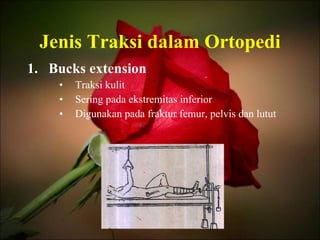 Jenis Traksi dalam Ortopedi Bucks extension Traksi kulit Sering pada ekstremitas inferior Digunakan pada fraktur femur, pelvis dan lutut 