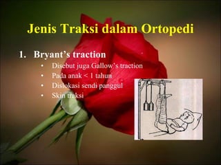 Jenis Traksi dalam Ortopedi Bryant’s traction Disebut juga Gallow’s traction Pada anak < 1 tahun Dislokasi sendi panggul Skin traksi 