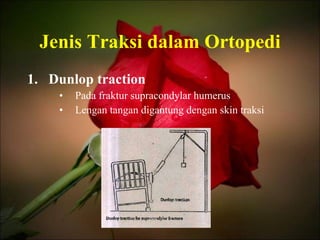Jenis Traksi dalam Ortopedi Dunlop traction Pada fraktur supracondylar humerus Lengan tangan digantung dengan skin traksi 