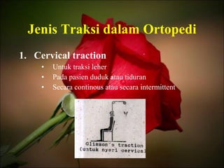 Jenis Traksi dalam Ortopedi Cervical traction Untuk traksi leher Pada pasien duduk atau tiduran Secara continous atau secara intermittent 