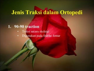 Jenis Traksi dalam Ortopedi 90-90 traction Traksi secara skeletal Digunakan pada fraktur femur 
