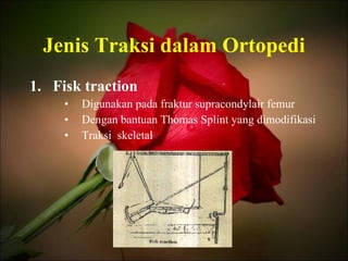 Jenis Traksi dalam Ortopedi Fisk traction Digunakan pada fraktur supracondylair femur Dengan bantuan Thomas Splint yang dimodifikasi Traksi  skeletal 