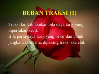 BEBAN TRAKSI (1) Traksi kulit dilakukan bila daya tarik yang  diperlukan kecil. Bila perlu daya tarik yang besar dan untuk  jangka waktu lama dipasang traksi skeletal. 