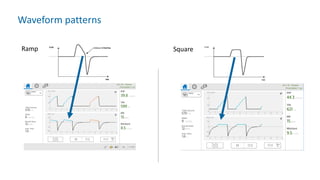 Waveform patterns
Ramp Square
 