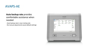 Auto Back-up rate
- Auto backup rate is near resting rate
- No manual adjustments (auto-default setting)
Auto backup rate provides
comfortable assistance when
needed
AVAPS-AE
 