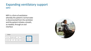 Expanding ventilatory support
MPV
MPV is a form of ventilation
whereby the patient’s normal state
is disconnected from the ventilator
and the patient initiates a breath,
as needed, through an oral
interface
 