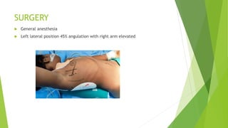TRANS-AXILLARY APPROACH OF ASD CLOSURE.pptx
