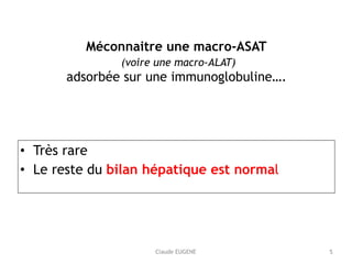 Claude EUGENE
 
Méconnaitre une macro-ASAT 
(voire une macro-ALAT)  
adsorbée sur une immunoglobuline…. 
• Très rare
• Le reste du bilan hépatique est normal
5
 