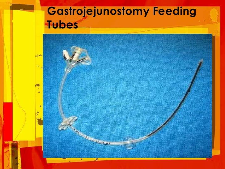 Transabdominal tube feeding and care