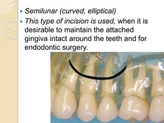 Transalveolar Extraction | PPTX