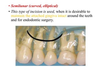 Transalveolar extraction and intraalveolar .pptx