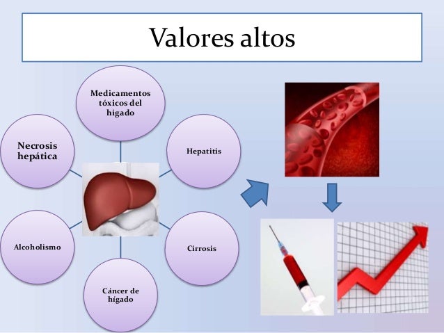 Transaminasa gpt en suero Transaminasa gpt en suero