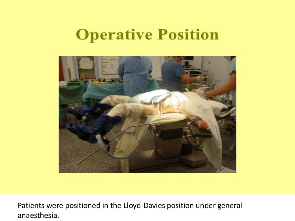 Transanal total mesorectal excision