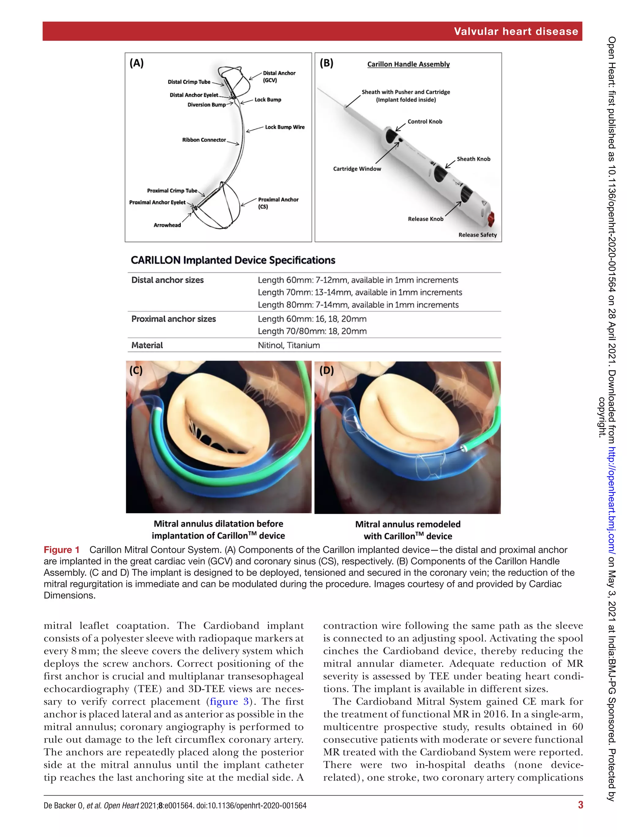 Transcatheter mitral valve repair | PDF | Heart and Cardiovascular ...