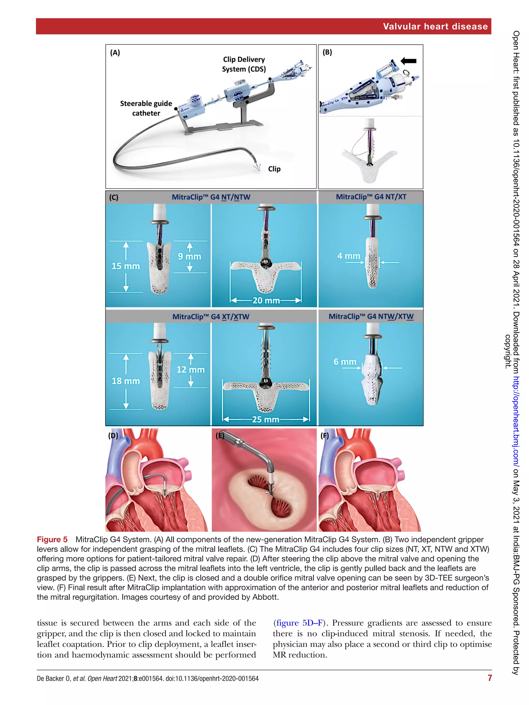 Transcatheter mitral valve repair | PDF | Heart and Cardiovascular ...