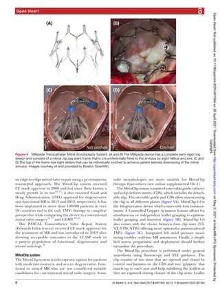 Open Heart
6 De Backer O, et al. Open Heart 2021;8:e001564. doi:10.1136/openhrt-2020-001564
an edge-­to-­edge mitral valve repair using a percutaneous
transseptal approach. The MitraClip system received
CE mark approval in 2008 and has since then known a
steady growth in its use12–15
; it also received Food and
Drug Administration (FDA) approval for degenerative
and functional MR in 2013 and 2019, respectively. It has
been implanted in more than 100 000 patients in over
50 countries and is the only TMVr therapy to complete
prospective trials comparing the device to conventional
mitral valve surgery16 17
and GDMT.18–21
The PASCAL Transcatheter Valve Repair System
(Edwards Lifesciences) received CE mark approval for
the treatment of MR and was introduced in 2019 after
showing acceptable outcomes in the CLASP study in
a patient population of functional, degenerative and
mixed aetiology.22
MitraClip system
The MitraClip system is a therapeutic option for patients
with moderate-­
to-­
severe and severe degenerative, func-
tional or mixed MR who are not considered suitable
candidates for conventional mitral valve surgery. Some
valve morphologies are more suitable for MitraClip
therapy than others (see online supplemental file 1).
TheMitraClipsystemconsistsofasteerableguidecatheter
and a clip delivery system (CDS), which includes the detach-
able clip. The steerable guide and CDS allow manoeuvring
the clip in all different planes (figure 5A). MitraClip G4 is
the 4th-­
generation device which comes with four enhance-
ments. A Controlled Gripper Actuation feature allows for
simultaneous or independent leaflet grasping to optimise
leaflet grasping and insertion (figure 5B). MitraClip G4
also comes with the choice between four clip sizes (NT,
XT, NTW, XTW) offering more options for patient-­
tailored
TMVr (figure 5C). Integrated left atrial pressure moni-
toring enables real-­
time MR assessment. Finally, a simpli-
fied system preparation and deployment should further
streamline the procedure.
The MitraClip procedure is performed under general
anaesthesia using fluoroscopy and TEE guidance. The
clip consists of two arms that are opened and closed by
control mechanisms on the CDS and two ‘grippers’ that
match up to each arm and help stabilising the leaflets as
they are captured during closure of the clip arms. Leaflet
Figure 4  Millipede Transcatheter Mitral Annuloplasty System. (A and B) The Millipede device has a complete semi-­
rigid ring
design and consists of a nitinol zig-­
zag stent frame that is circumferentially fixed to the annulus by eight helical anchors. (C and
D) The top of the frame has eight sliders that can be individually cinched to achieve patient-­
tailored downsizing of the mitral
annulus. Images courtesy of and provided by Boston Scientific.
copyright.
on
May
3,
2021
at
India:BMJ-PG
Sponsored.
Protected
by
http://openheart.bmj.com/
Open
Heart:
first
published
as
10.1136/openhrt-2020-001564
on
28
April
2021.
Downloaded
from
 