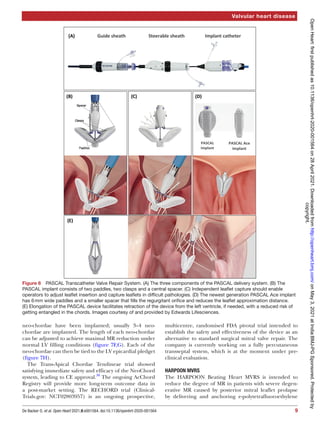 9
De Backer O, et al. Open Heart 2021;8:e001564. doi:10.1136/openhrt-2020-001564
Valvular heart disease
neo-­
chordae have been implanted; usually 3–4 neo-­
chordae are implanted. The length of each neo-­
chordae
can be adjusted to achieve maximal MR reduction under
normal LV filling conditions (figure 7F,G). Each of the
neo-­
chordae can then be tied to the LV epicardial pledget
(figure 7H).
The Trans-­
Apical Chordae Tendineae trial showed
satisfying immediate safety and efficacy of the NeoChord
system, leading to CE approval.30
The ongoing AcChord
Registry will provide more long-­
term outcome data in
a post-­
market setting. The RECHORD trial (​
Clinical-
Trials.​
gov: NCT02803957) is an ongoing prospective,
multicentre, randomised FDA pivotal trial intended to
establish the safety and effectiveness of the device as an
alternative to standard surgical mitral valve repair. The
company is currently working on a fully percutaneous
transseptal system, which is at the moment under pre-­
clinical evaluation.
HARPOON MVRS
The HARPOON Beating Heart MVRS is intended to
reduce the degree of MR in patients with severe degen-
erative MR caused by posterior mitral leaflet prolapse
by delivering and anchoring e-­
polytetrafluoroethylene
Figure 6  PASCAL Transcatheter Valve Repair System. (A) The three components of the PASCAL delivery system. (B) The
PASCAL implant consists of two paddles, two clasps and a central spacer. (C) Independent leaflet capture should enable
operators to adjust leaflet insertion and capture leaflets in difficult pathologies. (D) The newest generation PASCAL Ace implant
has 6 mm wide paddles and a smaller spacer that fills the regurgitant orifice and reduces the leaflet approximation distance.
(E) Elongation of the PASCAL device facilitates retraction of the device from the left ventricle, if needed, with a reduced risk of
getting entangled in the chords. Images courtesy of and provided by Edwards Lifesciences.
copyright.
on
May
3,
2021
at
India:BMJ-PG
Sponsored.
Protected
by
http://openheart.bmj.com/
Open
Heart:
first
published
as
10.1136/openhrt-2020-001564
on
28
April
2021.
Downloaded
from
 