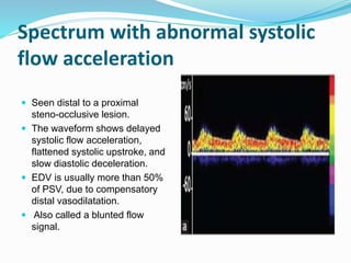 Spectrum with abnormal systolic
flow acceleration
 Seen distal to a proximal
steno-occlusive lesion.
 The waveform shows delayed
systolic flow acceleration,
flattened systolic upstroke, and
slow diastolic deceleration.
 EDV is usually more than 50%
of PSV, due to compensatory
distal vasodilatation.
 Also called a blunted flow
signal.
 