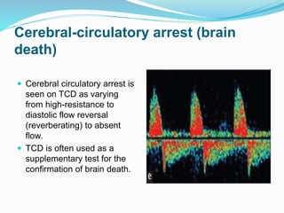 Cerebral-circulatory arrest (brain
death)
 Cerebral circulatory arrest is
seen on TCD as varying
from high-resistance to
diastolic flow reversal
(reverberating) to absent
flow.
 TCD is often used as a
supplementary test for the
confirmation of brain death.
 