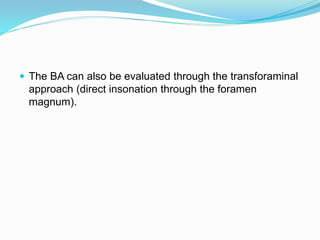  The BA can also be evaluated through the transforaminal
approach (direct insonation through the foramen
magnum).
 