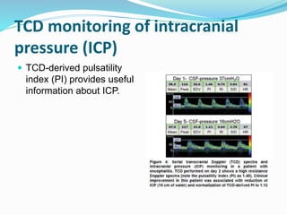 TCD monitoring of intracranial
pressure (ICP)
 TCD-derived pulsatility
index (PI) provides useful
information about ICP.
 