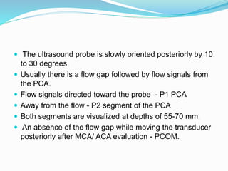  The ultrasound probe is slowly oriented posteriorly by 10
to 30 degrees.
 Usually there is a flow gap followed by flow signals from
the PCA.
 Flow signals directed toward the probe - P1 PCA
 Away from the flow - P2 segment of the PCA
 Both segments are visualized at depths of 55-70 mm.
 An absence of the flow gap while moving the transducer
posteriorly after MCA/ ACA evaluation - PCOM.
 