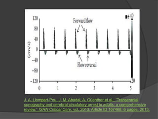 J. A. Llompart-Pou, J. M. Abadal, A. Güenther et al., “Transcranial
sonography and cerebral circulatory arrest in adults: a comprehensive
review,” ISRN Critical Care, vol. 2013, Article ID 167468, 6 pages, 2013.
 