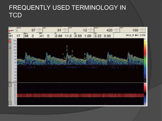FREQUENTLY USED TERMINOLOGY IN
TCD
 