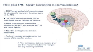 Tms Explained Transcranial magnetic stimulation | PPTX