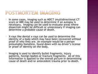    In some cases, imaging such as MDCT (multidirectional CT
    scan) or MRI may be used to determine if an autopsy is
    necessary. Imaging can be used to evaluate areas where
    dissection might be difficult or unnecessary if imaging can
    determine a probable cause of death.

   X-rays like dental x-rays can be used to determine the
    identity of a body which may have been recovered without
    proof of who they are. An example would be a person
    presumably homeless, found down with no driver’s license
    or proof of identity on the body.

   Imaging is used to identify bullet fragments, injury
    patterns, foreign bodies or fracture fragments. All of this
    information is applied to the overall picture in determining
    cause of death and/or antecedent trauma prior to death.
 
 
