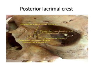 Posterior Lacrimal Crest