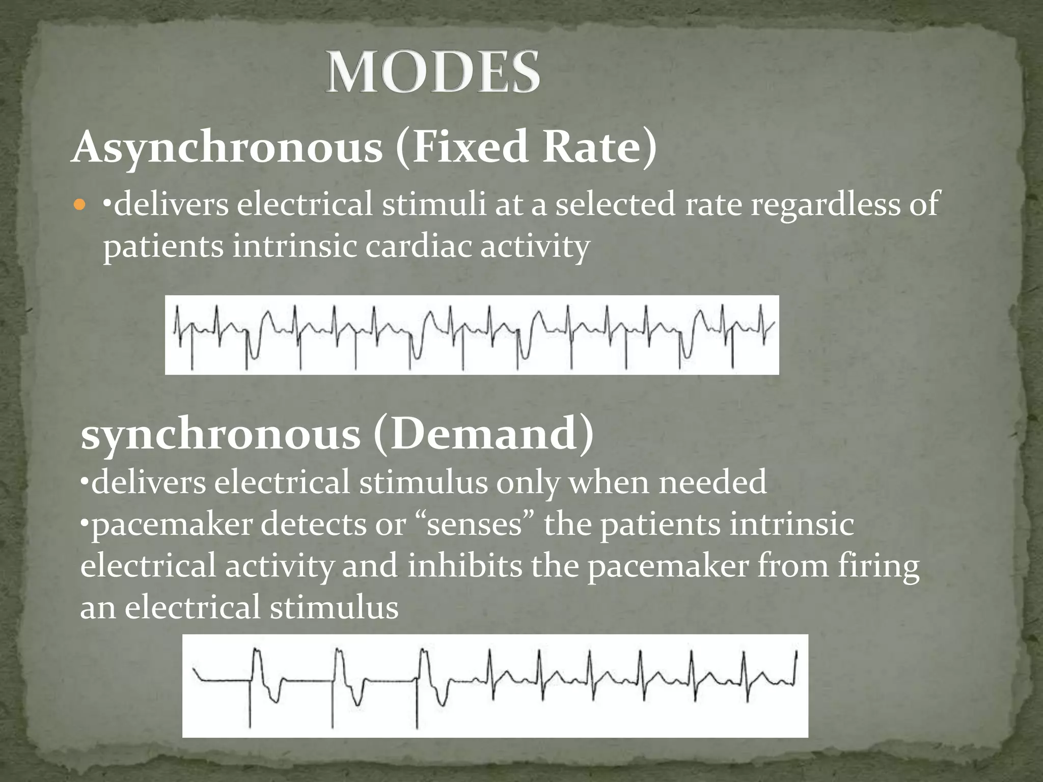 Transcutaneous pacing | PPTX