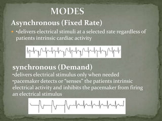 Transcutaneous pacing | PPT