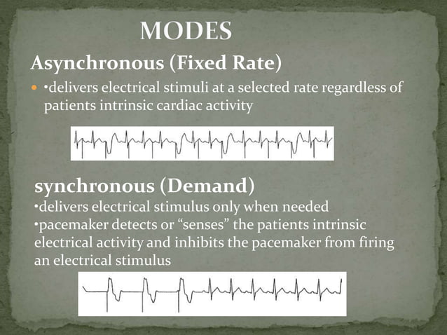 Transcutaneous pacing