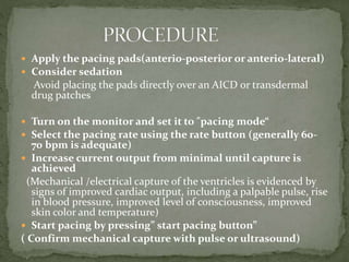 Transcutaneous pacing | PPT