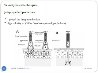 Velocity based technique-
Jet-propelled particles:-
It propel the drug into the skin.
High velocity jet (100m/s) of compressed gas (helium).
06/04/16SAGAR KISHOR SAVALE59
 