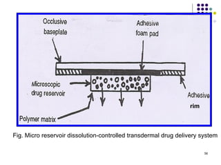 rim



Fig. Micro reservoir dissolution-controlled transdermal drug delivery system

                                                                       56
 