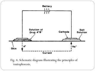 Fig. 4. Schematic diagram illustrating the principles of iontophoresis. 