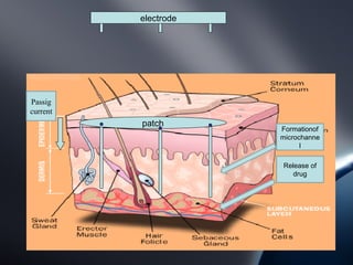 electrode




Passig
current
          patch
                      Formationof
                      microchanne
                            l

                      Release of
                         drug
 