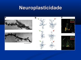 Neuroplasticidade
 