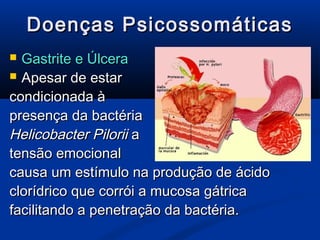 Doenças Psicossomáticas
 Gastrite e Úlcera
 Apesar de estar

condicionada à
presença da bactéria
Helicobacter Pilorii a
tensão emocional
causa um estímulo na produção de ácido
clorídrico que corrói a mucosa gátrica
facilitando a penetração da bactéria.
 