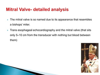 The mitral valve is so named due to its appearance that resembles
a bishops’ miter.
 Trans esophageal echocardiography and the mitral valve (that sits
only 5–10 cm from the transducer with nothing but blood between
them)
 