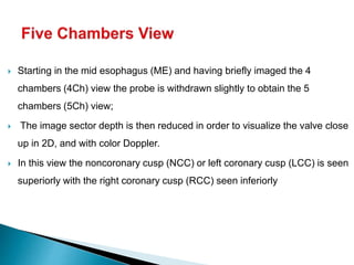  Starting in the mid esophagus (ME) and having briefly imaged the 4
chambers (4Ch) view the probe is withdrawn slightly to obtain the 5
chambers (5Ch) view;
 The image sector depth is then reduced in order to visualize the valve close
up in 2D, and with color Doppler.
 In this view the noncoronary cusp (NCC) or left coronary cusp (LCC) is seen
superiorly with the right coronary cusp (RCC) seen inferiorly
 