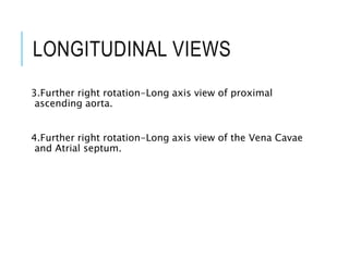 LONGITUDINAL VIEWS
3.Further right rotation-Long axis view of proximal
ascending aorta.
4.Further right rotation-Long axis view of the Vena Cavae
and Atrial septum.
 