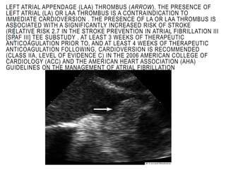 LEFT ATRIAL APPENDAGE (LAA) THROMBUS (ARROW). THE PRESENCE OF
LEFT ATRIAL (LA) OR LAA THROMBUS IS A CONTRAINDICATION TO
IMMEDIATE CARDIOVERSION . THE PRESENCE OF LA OR LAA THROMBUS IS
ASSOCIATED WITH A SIGNIFICANTLY INCREASED RISK OF STROKE
(RELATIVE RISK 2.7 IN THE STROKE PREVENTION IN ATRIAL FIBRILLATION III
[SPAF III] TEE SUBSTUDY . AT LEAST 3 WEEKS OF THERAPEUTIC
ANTICOAGULATION PRIOR TO, AND AT LEAST 4 WEEKS OF THERAPEUTIC
ANTICOAGULATION FOLLOWING, CARDIOVERSION IS RECOMMENDED
(CLASS IIA, LEVEL OF EVIDENCE C) IN THE 2006 AMERICAN COLLEGE OF
CARDIOLOGY (ACC) AND THE AMERICAN HEART ASSOCIATION (AHA)
GUIDELINES ON THE MANAGEMENT OF ATRIAL FIBRILLATION
 