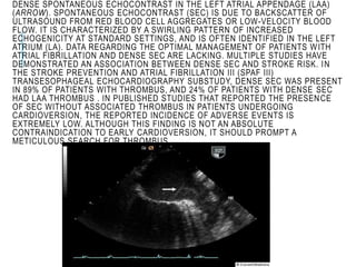 DENSE SPONTANEOUS ECHOCONTRAST IN THE LEFT ATRIAL APPENDAGE (LAA)
(ARROW). SPONTANEOUS ECHOCONTRAST (SEC) IS DUE TO BACKSCATTER OF
ULTRASOUND FROM RED BLOOD CELL AGGREGATES OR LOW-VELOCITY BLOOD
FLOW. IT IS CHARACTERIZED BY A SWIRLING PATTERN OF INCREASED
ECHOGENICITY AT STANDARD SETTINGS, AND IS OFTEN IDENTIFIED IN THE LEFT
ATRIUM (LA). DATA REGARDING THE OPTIMAL MANAGEMENT OF PATIENTS WITH
ATRIAL FIBRILLATION AND DENSE SEC ARE LACKING. MULTIPLE STUDIES HAVE
DEMONSTRATED AN ASSOCIATION BETWEEN DENSE SEC AND STROKE RISK. IN
THE STROKE PREVENTION AND ATRIAL FIBRILLATION III (SPAF III)
TRANSESOPHAGEAL ECHOCARDIOGRAPHY SUBSTUDY, DENSE SEC WAS PRESENT
IN 89% OF PATIENTS WITH THROMBUS, AND 24% OF PATIENTS WITH DENSE SEC
HAD LAA THROMBUS . IN PUBLISHED STUDIES THAT REPORTED THE PRESENCE
OF SEC WITHOUT ASSOCIATED THROMBUS IN PATIENTS UNDERGOING
CARDIOVERSION, THE REPORTED INCIDENCE OF ADVERSE EVENTS IS
EXTREMELY LOW. ALTHOUGH THIS FINDING IS NOT AN ABSOLUTE
CONTRAINDICATION TO EARLY CARDIOVERSION, IT SHOULD PROMPT A
METICULOUS SEARCH FOR THROMBUS
 