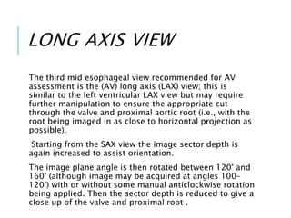 LONG AXIS VIEW
The third mid esophageal view recommended for AV
assessment is the (AV) long axis (LAX) view; this is
similar to the left ventricular LAX view but may require
further manipulation to ensure the appropriate cut
through the valve and proximal aortic root (i.e., with the
root being imaged in as close to horizontal projection as
possible).
Starting from the SAX view the image sector depth is
again increased to assist orientation.
The image plane angle is then rotated between 120° and
160° (although image may be acquired at angles 100–
120°) with or without some manual anticlockwise rotation
being applied. Then the sector depth is reduced to give a
close up of the valve and proximal root .
 